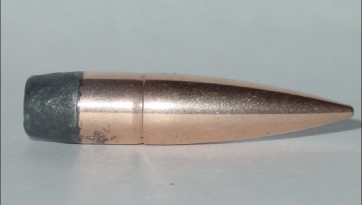 /magazine/joven-fue-a-hospital-por-dolor-en-el-recto-y-le-extrajeron-bala-de-la